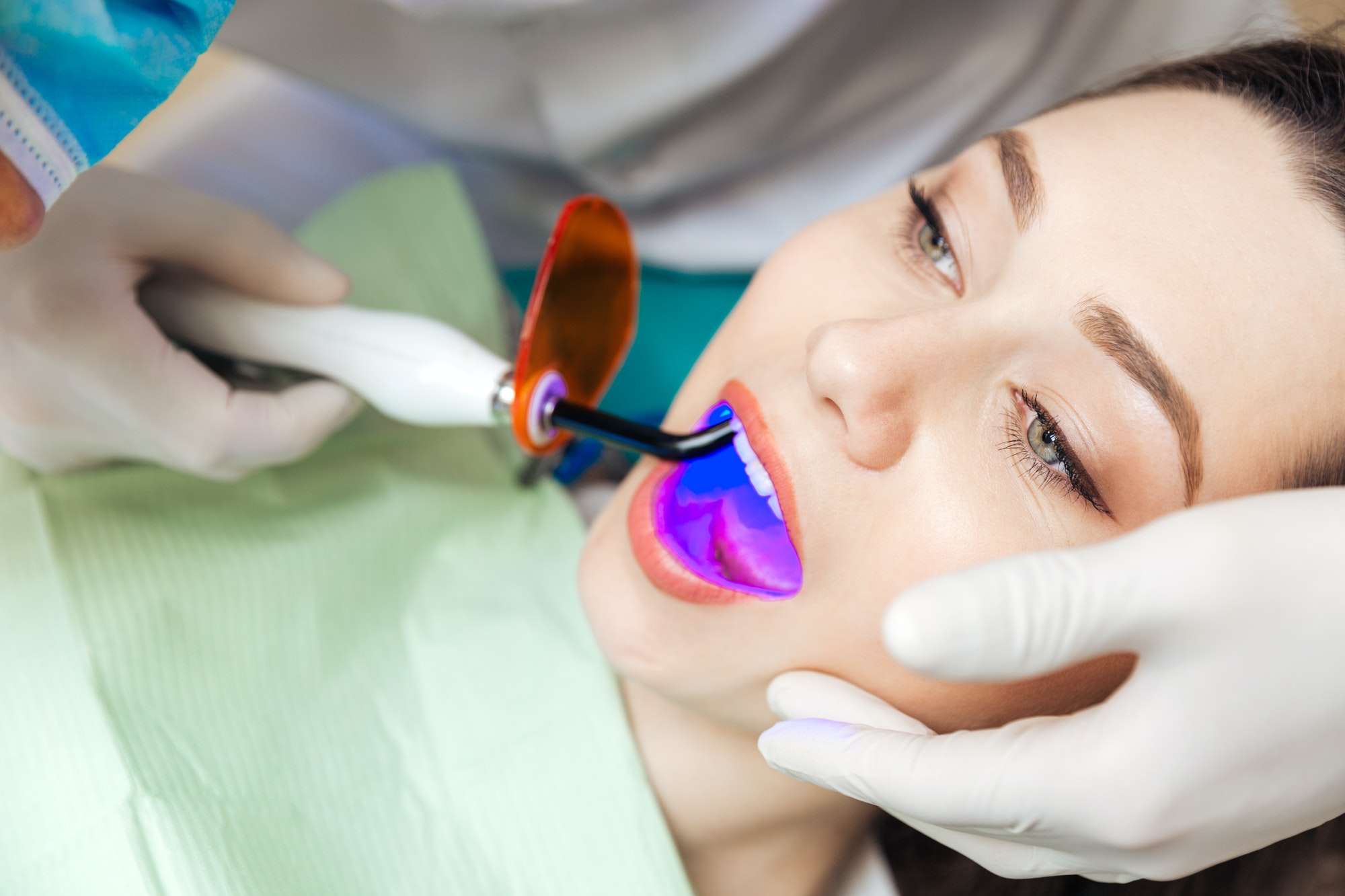 Blanqueamiento Close up portrait of a pretty girl getting teeth bleached