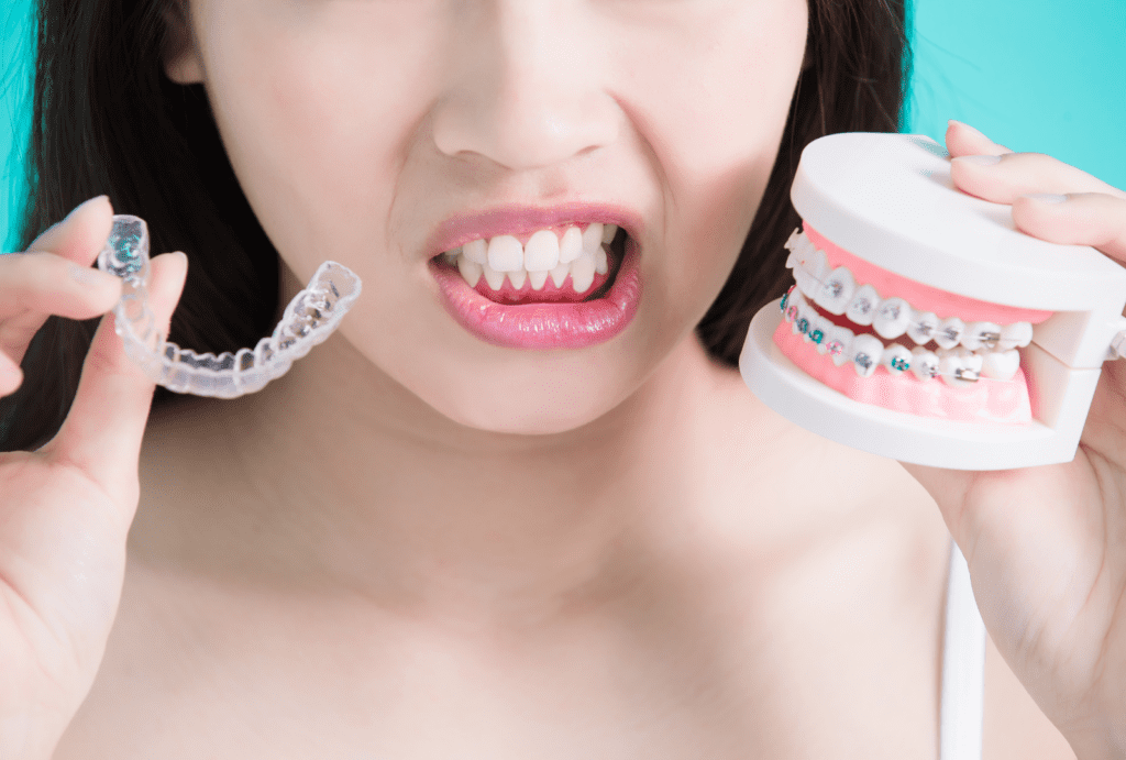 Alineadores Invisalign Aligners - Alineadores Invisalign