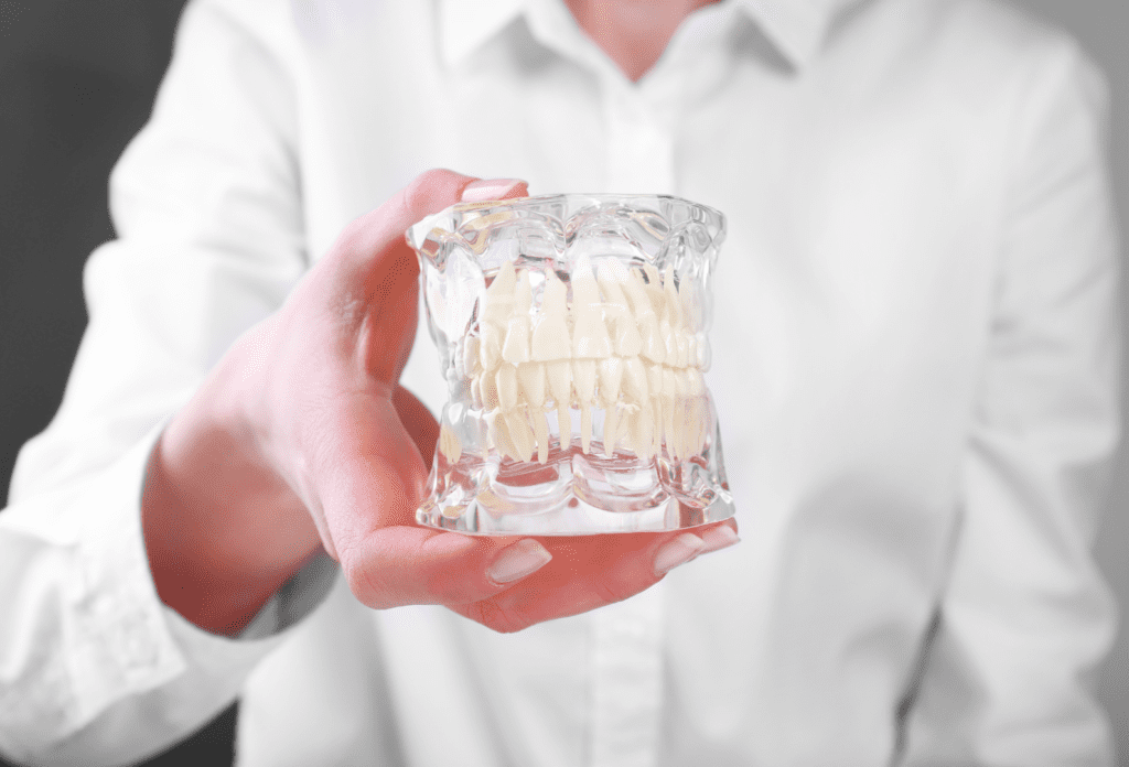 Coronas de Porcelana Porcelain Crowns - Coronas de Porcelana