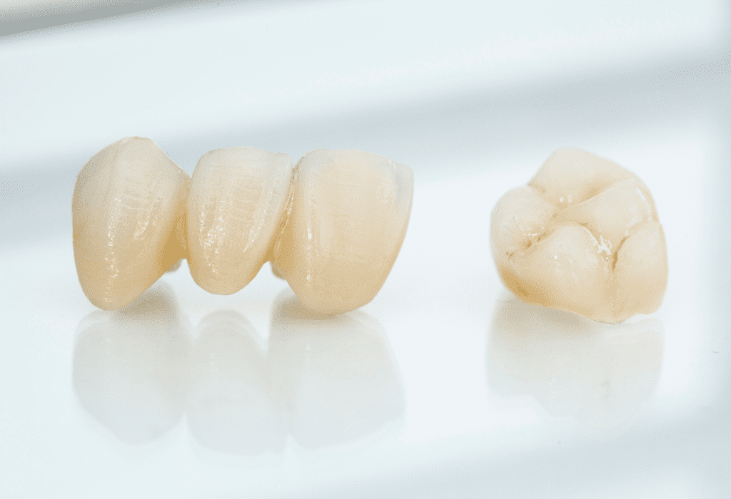 Coronas de Porcelana Porcelain Crowns - Coronas de Porcelana
