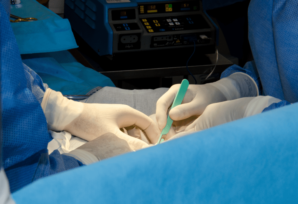 Apnea del Sueño Sleep Apnea - Apnea del Sueño