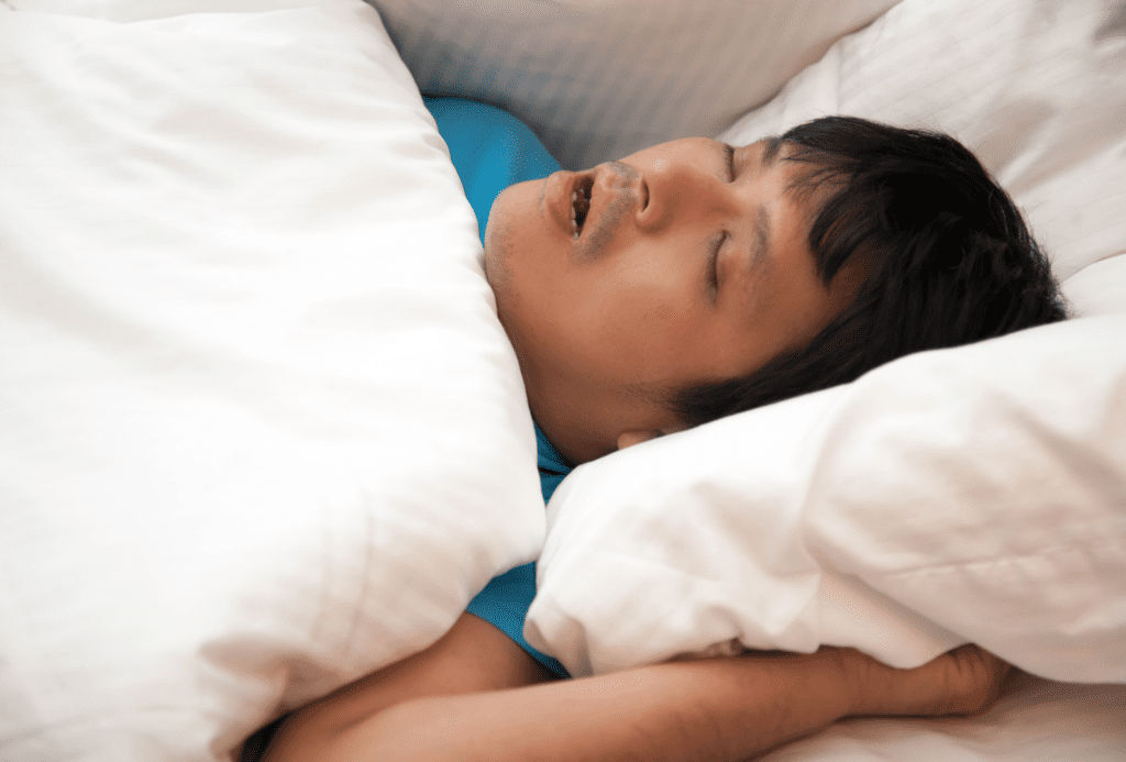 Apnea del Sueño Sleep Apnea - Apnea del Sueño