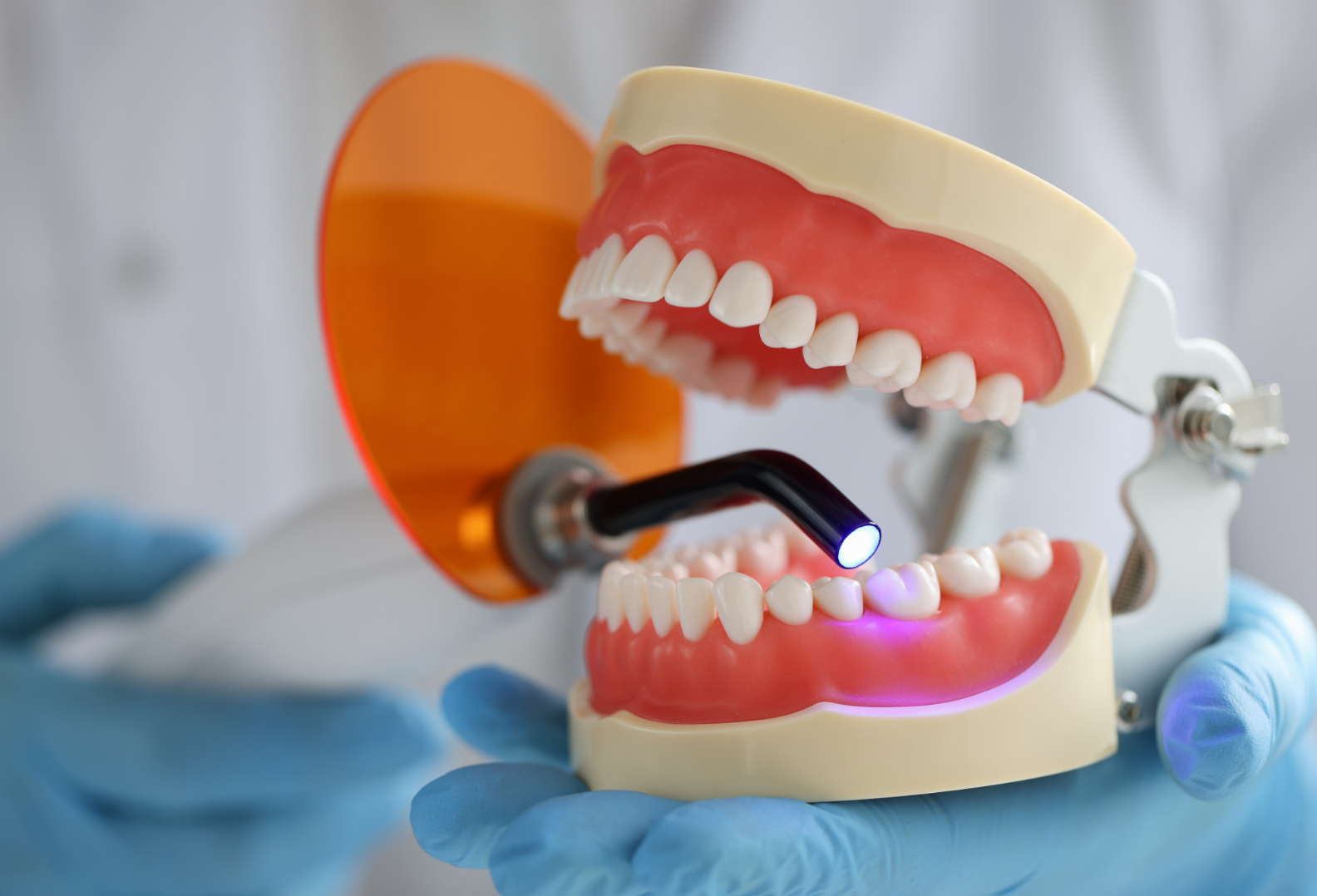 Snap on Smile - Sonrisa a Presión