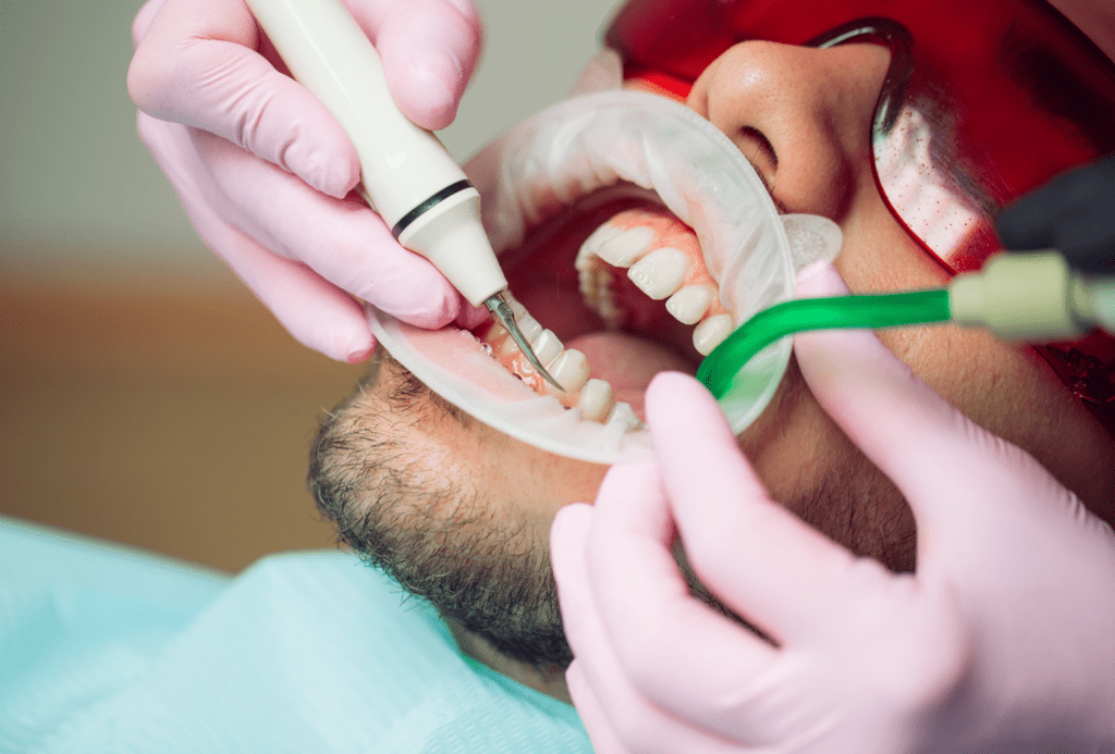 Teeth Cleaning - Limpieza Dental