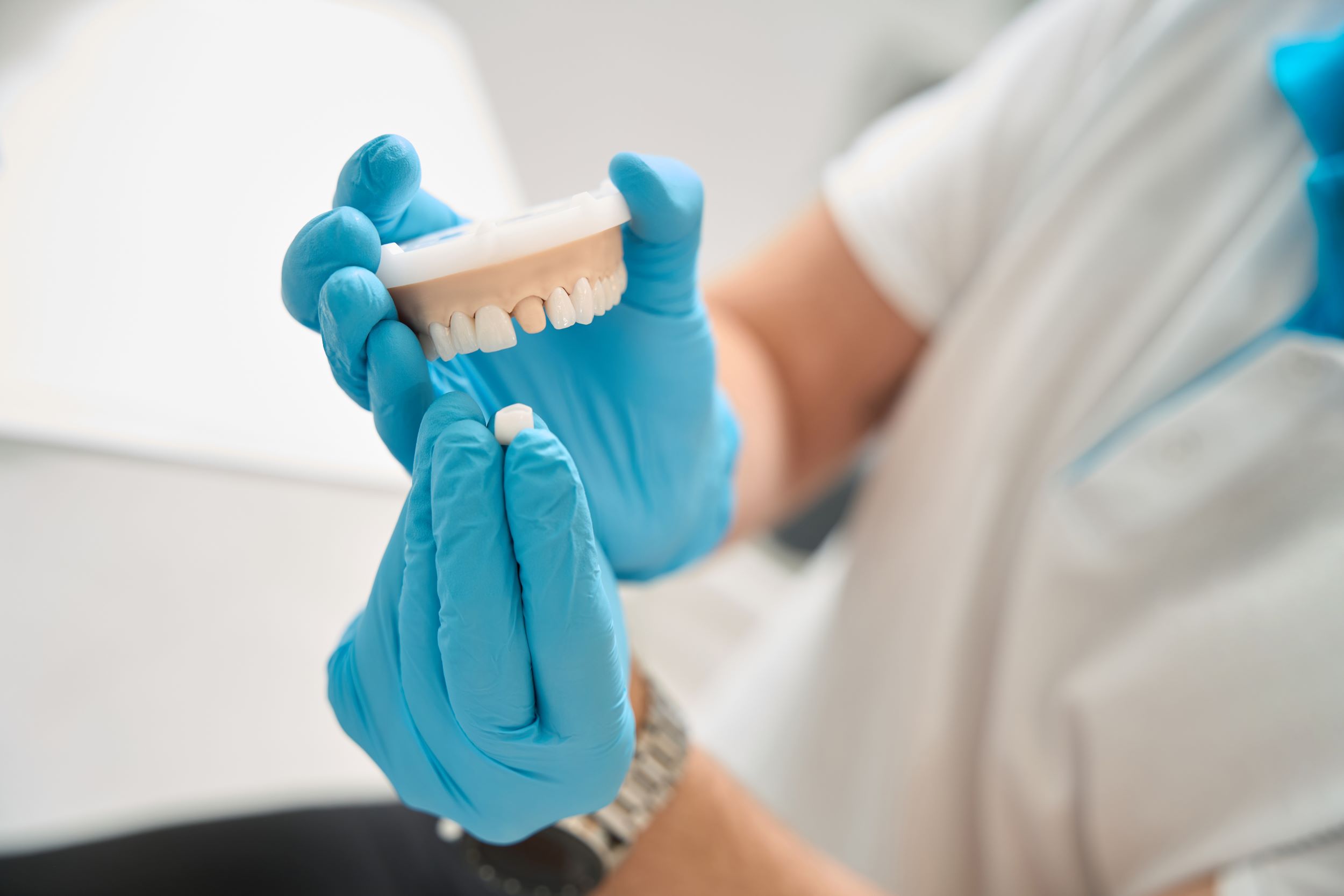 Coronas Dentales Dental crowns